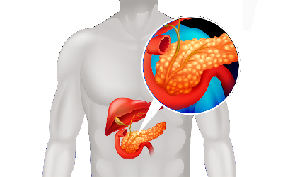 Pancreatitis Ayurveda Treatment And Remedies