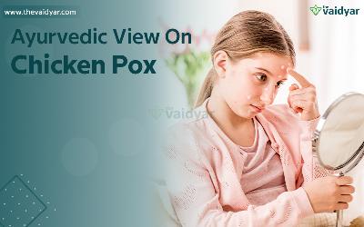 Ayurvedic Approaches And Treatment To Cure Chickenpox