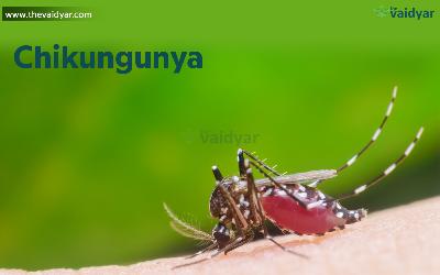 Ayurvedic Treatment For Chikungunya