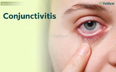 Ayurvedic Management Of Conjunctivitis