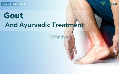 Relevance Of Ayurvedic Treatment And Herbs To Cure Gout