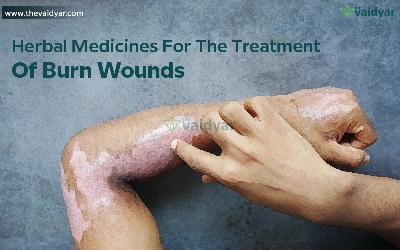 Herbal Medicines For The Treatment Of Burn Wounds