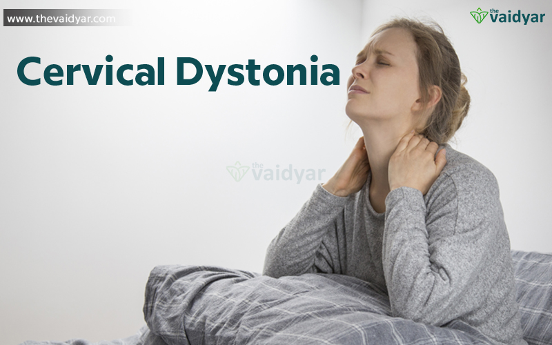 cervical dystonia