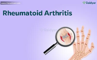 Ayurvedic Management Of Rheumatoid Arthritis