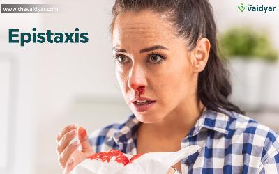 Ayurvedic Treatments For Epistaxis Or Nosebleed