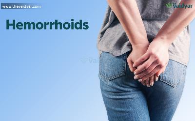 Ayurvedic Management Of Hemorrhoids Or Piles