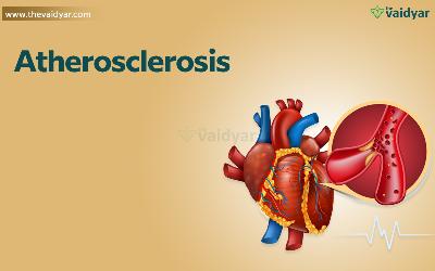 Ayurvedic Management Of Atherosclerosis
