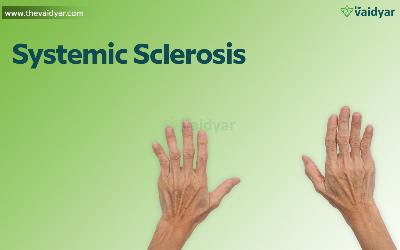 Effective Ayurvedic Tips To Control Systemic Sclerosis