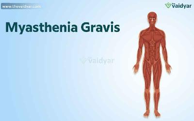 Ayurvedic Treatment Of Myasthenia Gravis